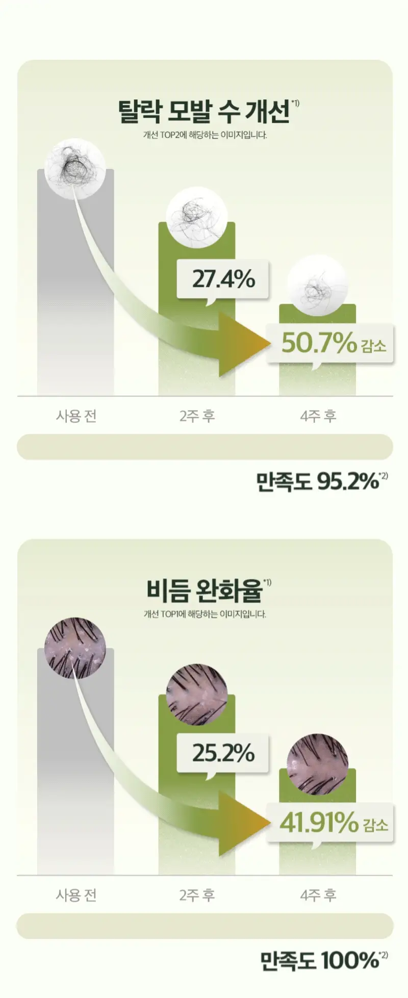 [단독기획] 려 루트젠 탈모전문케어 두피에센스 80ML(+샴푸 100ML) 기획 상세페이지 9